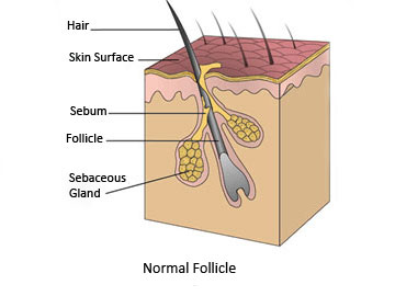 thumb_normalfollicle_revised
