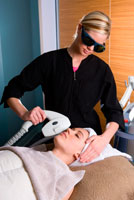 Acne-Laser-Therapy